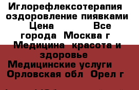 Иглорефлексотерапия, оздоровление пиявками › Цена ­ 3 000 - Все города, Москва г. Медицина, красота и здоровье » Медицинские услуги   . Орловская обл.,Орел г.